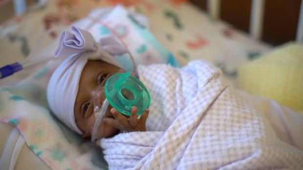 Cô gái bé nhỏ nhất thế giới Saybie. (Nguồn: cbsnews.com)