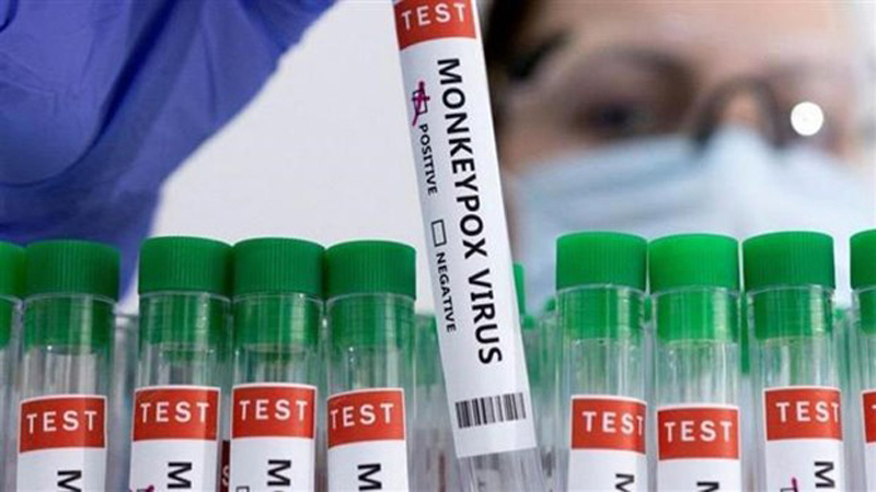 Các mẫu bệnh phẩm của bệnh nhân mắc đậu mùa khỉ. (Ảnh: Reuters/TTXVN)