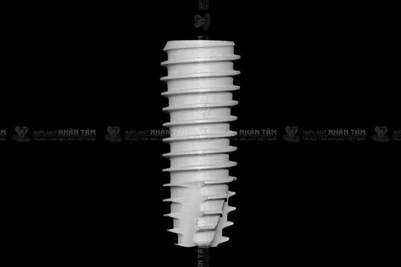 Chi phí trồng răng Implant sẽ khác nhau tùy theo loại trụ Implant