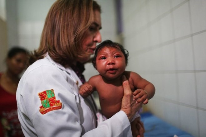 Thêm bằng chứng về sự liên hệ giữa virus Zika với chứng teo não