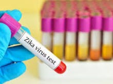 Bộ Y tế: 200 mẫu bệnh phẩm xét nghiệm virus Zika âm tính