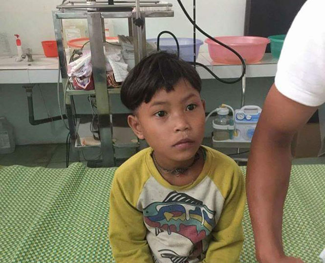 Một bé gái bị đỉa chui vào họng