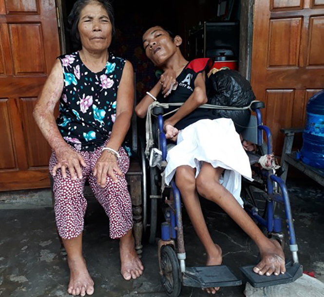 Bố ung thư, mẹ và con trai tật nguyền