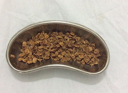 Lấy ra hơn 70 gr hạt sơri nảy mầm trong hậu môn bệnh nhi 11 tuổi