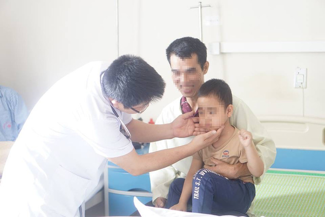 Tiêm 8 mũi corticoid, bé 5 tuổi mọc ria, ăn 4 bát cơm mỗi bữa