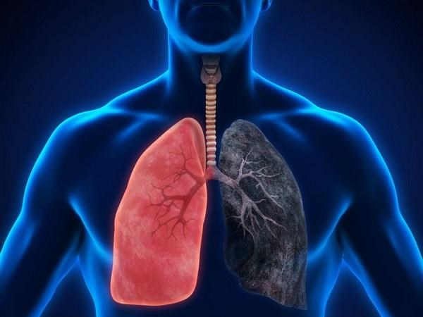 Phát hiện loài cây rừng kháng được bốn dòng ung thư