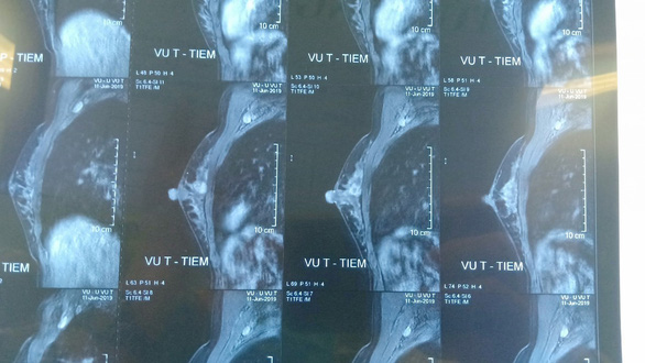 Sẽ nghiên cứu vắcxin điều trị ung thư tại Việt Nam