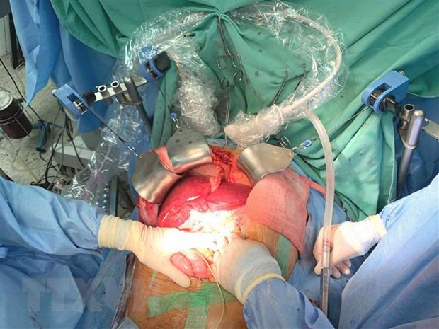 Bệnh viện Trung ương Huế thực hiện 21 ca ghép tạng trong 1 tháng