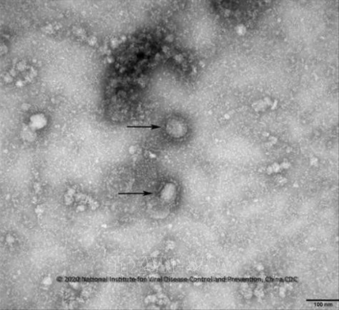 Thái Lan ghi nhận trường hợp thứ hai nhiễm chủng virus corona mới