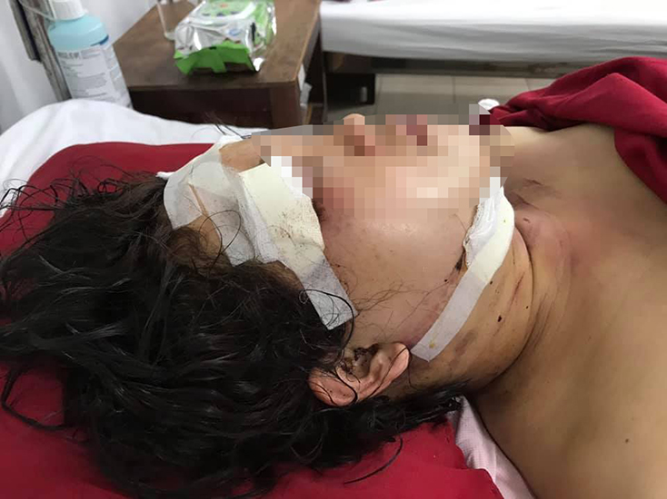 Tuyên Hóa: Chồng đánh vợ trọng thương rồi treo cổ tự tử