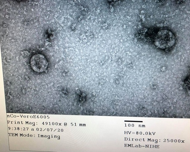 Việt Nam nuôi cấy và phân lập thành công virus corona chủng mới