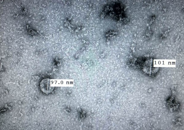 Các chủng cũ của virus corona có thể tồn tại ngoài vật chủ tới 9 ngày