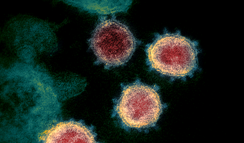 Viên nén chứa thuốc điều trị HIV không có tác dụng chống SARS-CoV-2