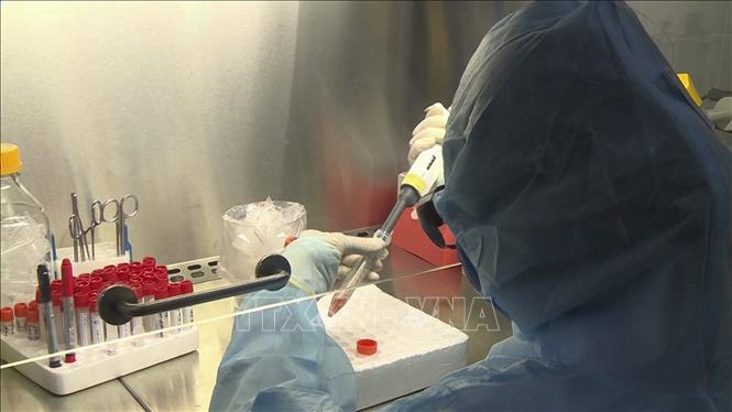 Dịch COVID-19: Tập trung nguồn lực chủ động sản xuất bộ xét nghiệm virus SARS-CoV-2