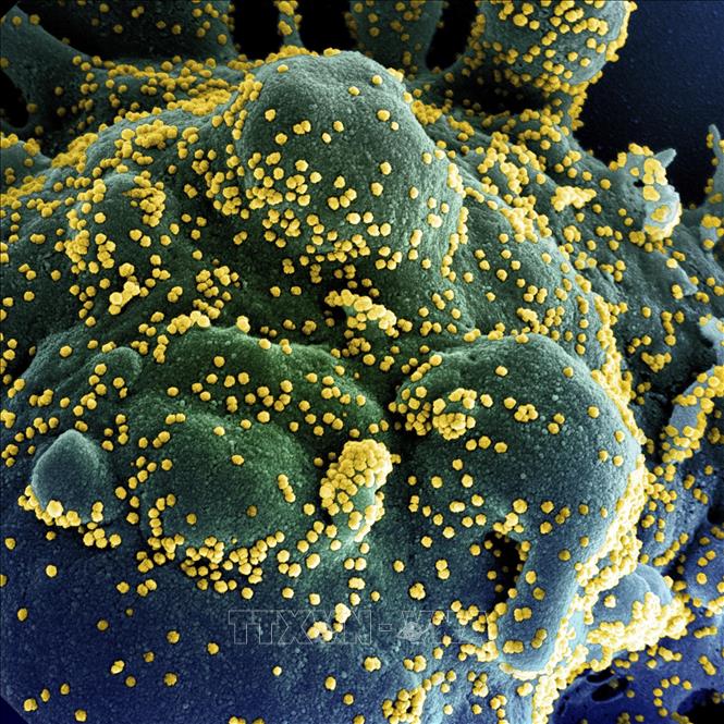 Nghiên cứu mới: Hoạt chất chiết xuất từ tinh dầu khuynh diệp có thể tiêu diệt virus SARS-CoV-2