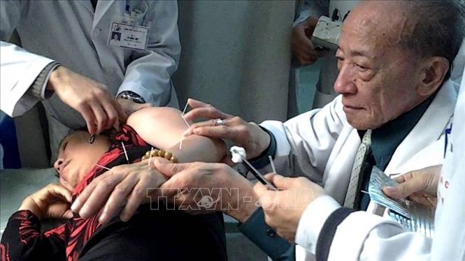 GS. Nguyễn Tài Thu qua đời, Việt Nam mất đi 'đôi bàn tay vàng' trong lĩnh vực châm cứu