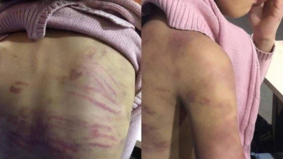 Phê chuẩn quyết định khởi tố bị can vụ hiếp dâm con riêng 'vợ hờ'