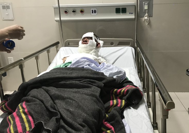 Sửa máy phát điện trên tàu cá, 3 ngư dân bị bỏng nặng