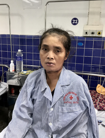 Phẫu thuật thành công bệnh nhân ung thư lưỡi