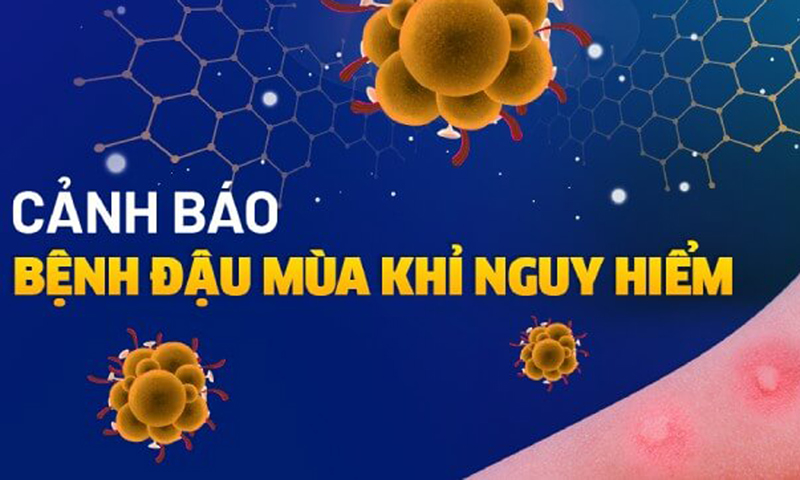 Tăng cường công tác phòng, chống bệnh đậu mùa khỉ