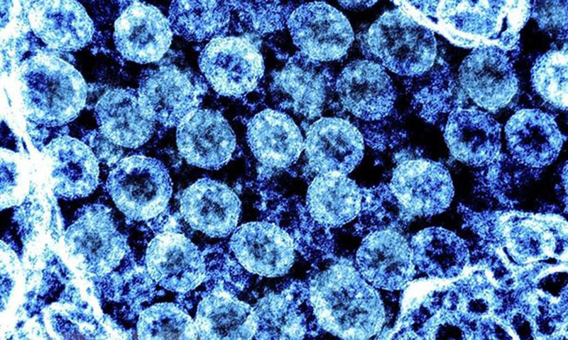 Virus gây bệnh COVID-19 có thể gây viêm não tương tự bệnh Parkinson