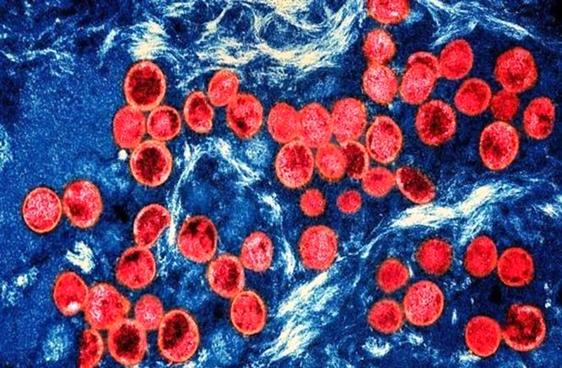 Virus gây bệnh đậu mùa khỉ lây lan khắp 5 khu vực ở châu Phi